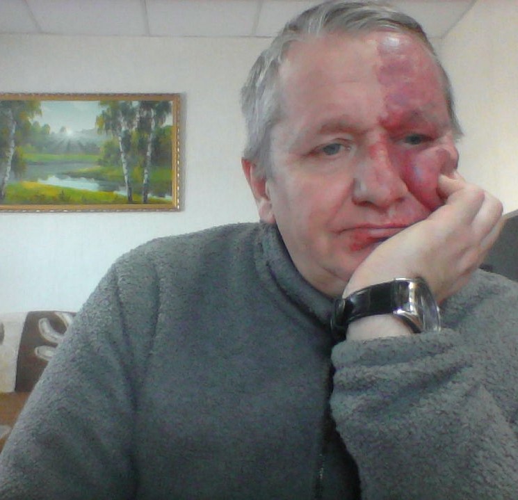 ������ ������� 2