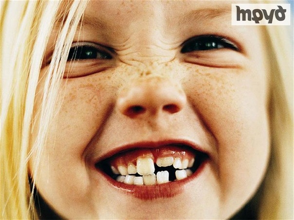 �������� ����