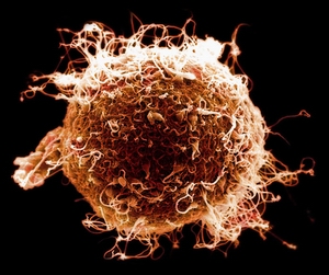 где рука словно вата Eго онемеет