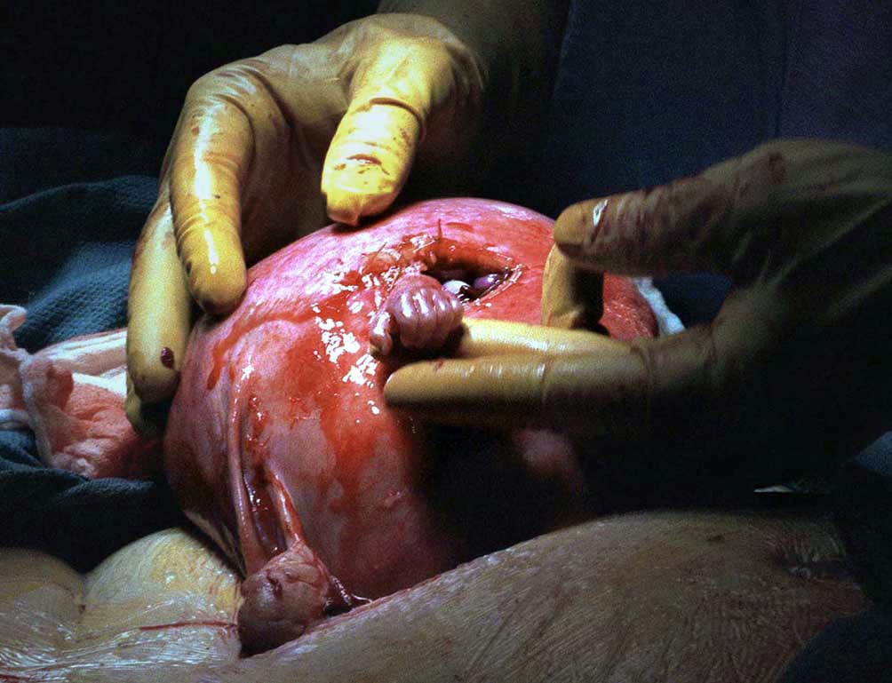 Решив однажды - не сберечь