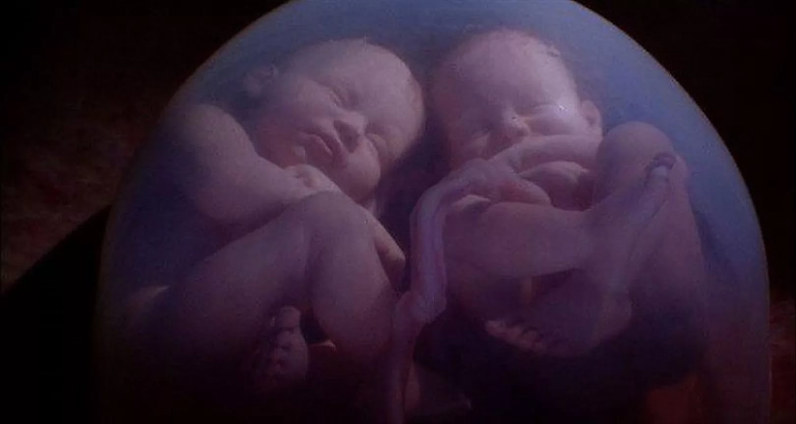 23 недели двойня. Беременность двойней по неделям. Близнецы и двойняшки в утробе.