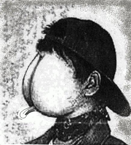 Исповедь реаниматолога-любителя