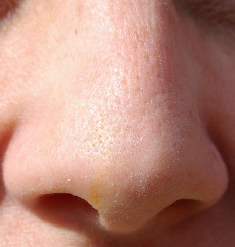 Улица, весна, мороз...