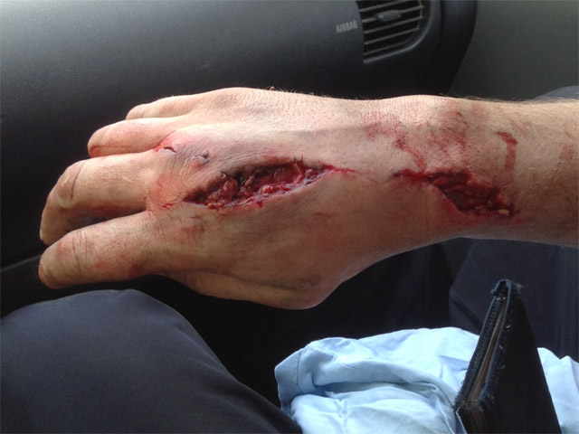 Песня. Травма