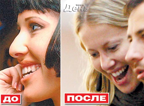 Фото ксении собчак до пластики Ксении Собчак Take 4 (Алекс Тимо) / Стихи.ру