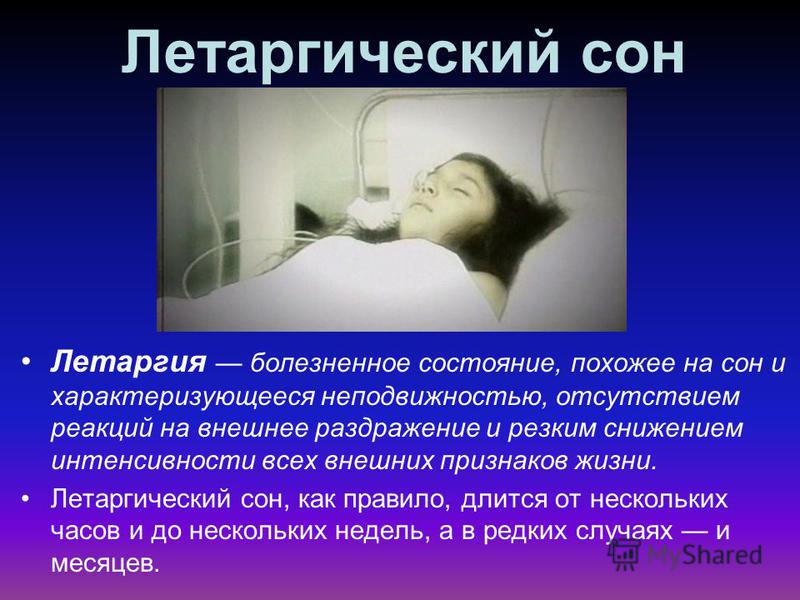 Заболевание вызванное потерями. Презентация на тему летаргический сон. Летаргия интересные факты. Летаргический сон и кома.
