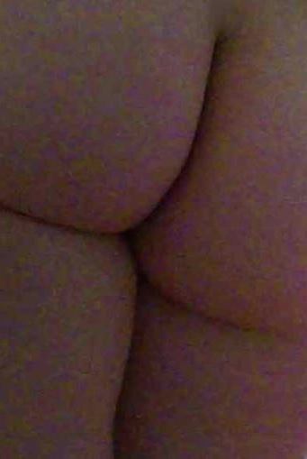 Радикулит - предатель