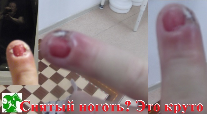 Снятый ноготь? Это круто!
