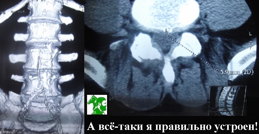 А всё-таки я правильно устроен!