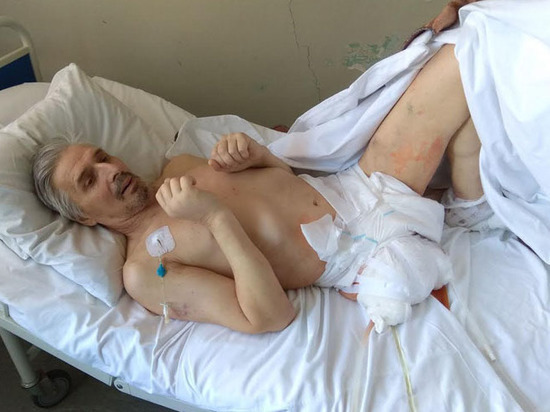 Кома в Пскове...