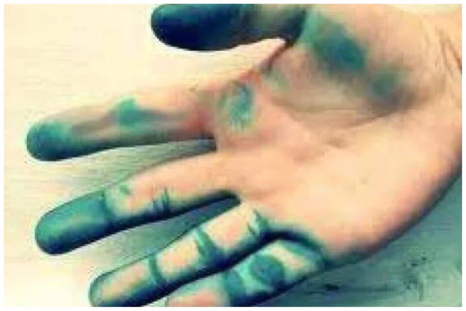 Руки испачканы выделенная полоса балованный. Зеленый руки от зеленки.