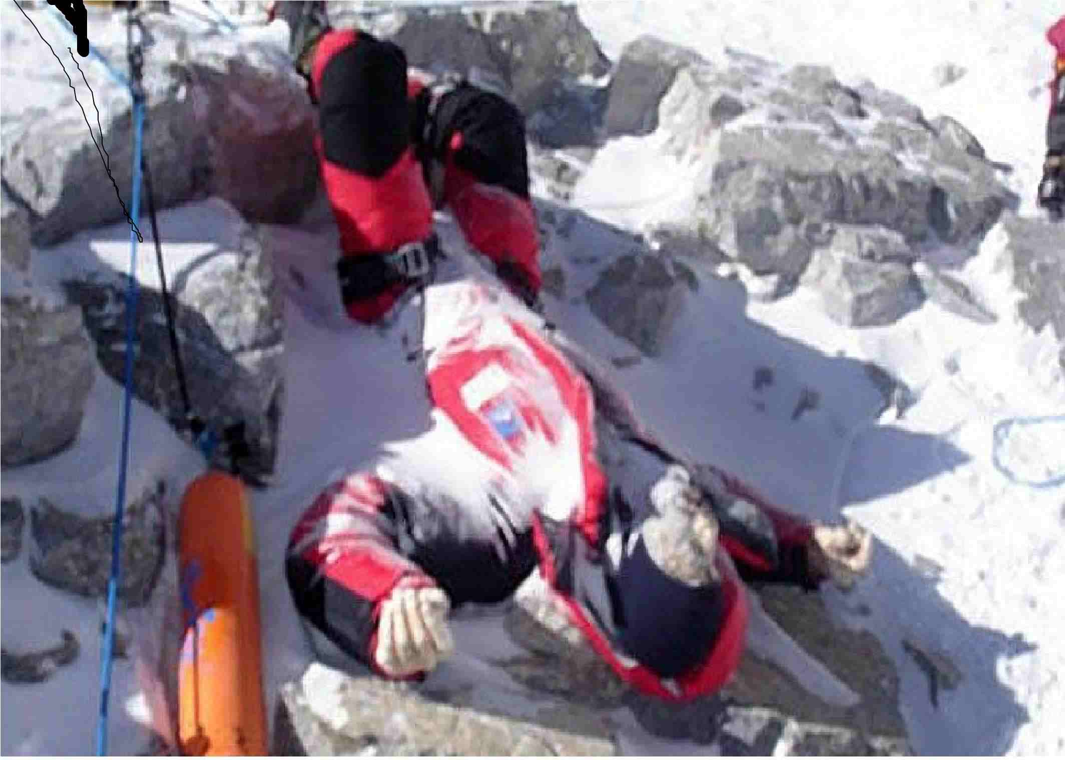 диагноз - горы