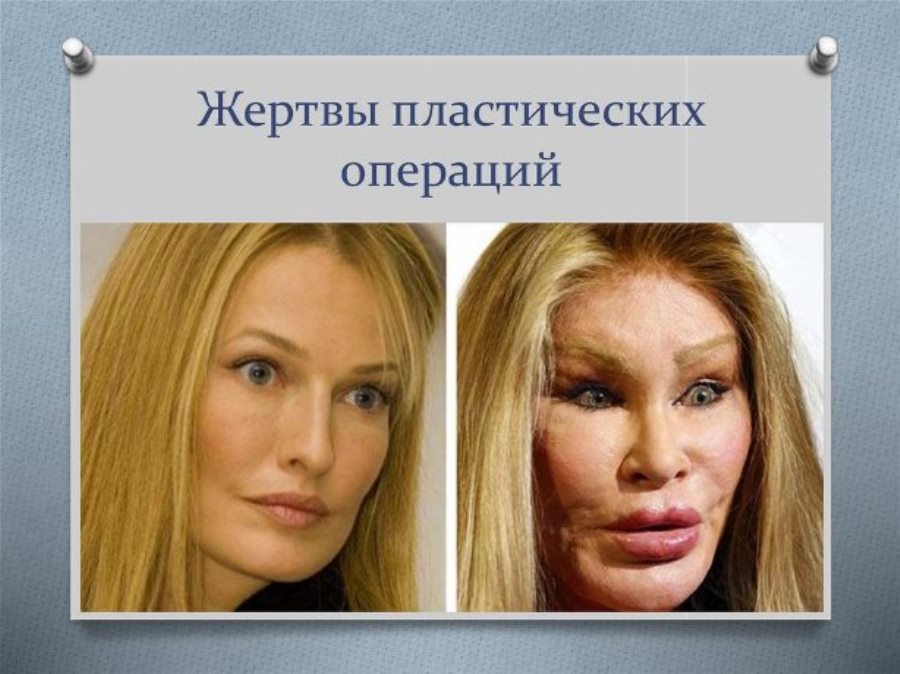 Лияна колесова до и после пластики Женщина мечтает быть красивой (Велижанина Галина) / Стихи.ру