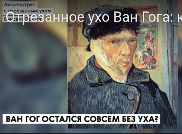 Зачем отрезали ухо террористу из крокус сити. Ван Гог ухо. Художник который отрезал себе ухо. Винсент Ван Гог отрубил себе ухо. Кто из художников отрезал ухо.