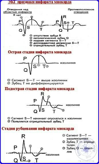Посвящение врачам кабинетов ЭКГ