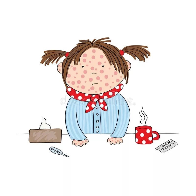 Ветрянка в 30