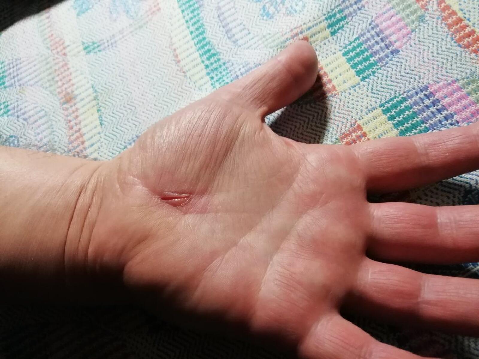 Продолжение линии жизни