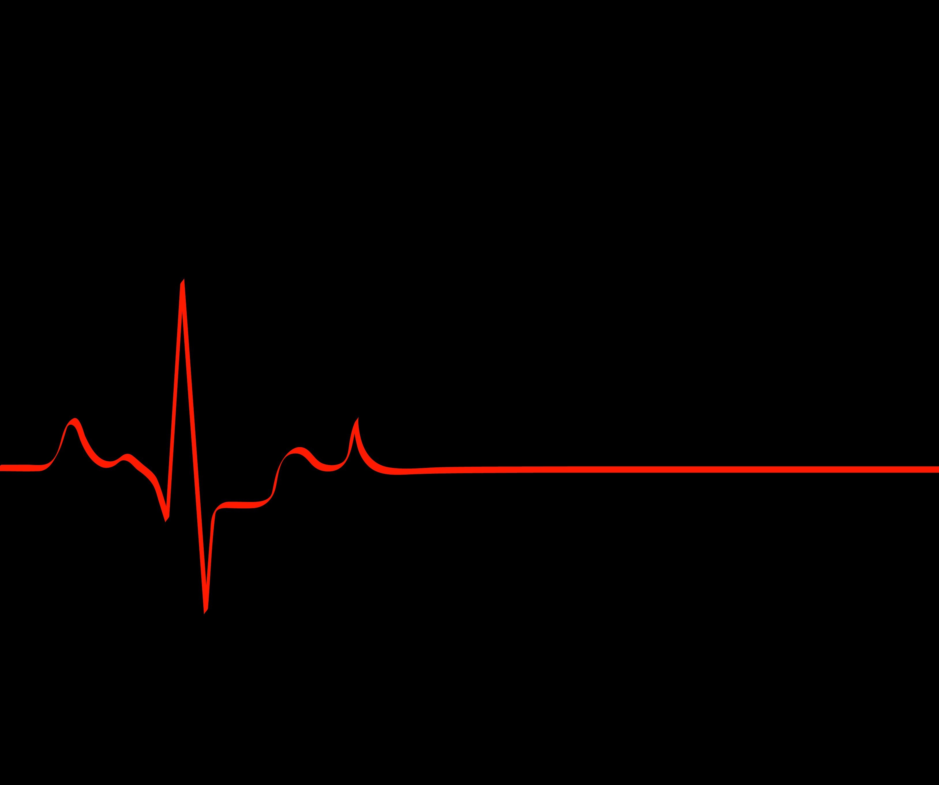 Сердцебиение остановилось. Кардиограмма остановки сердца. Пульс. Обои пульс. Кардиограмма серлце.