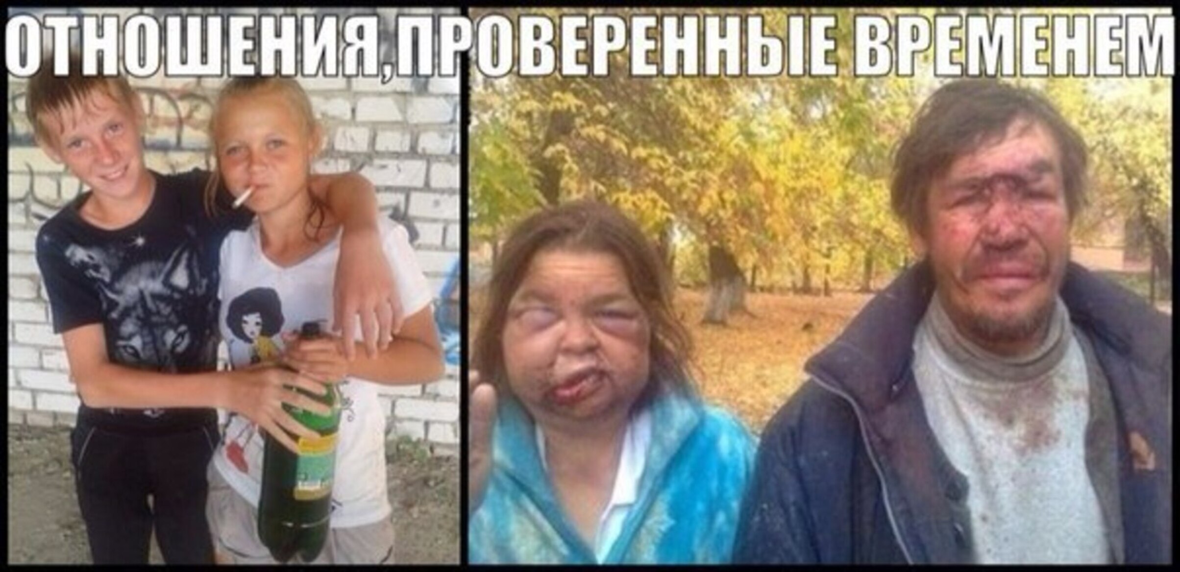 Бухло: до и после - фото людей, которые перестали пить