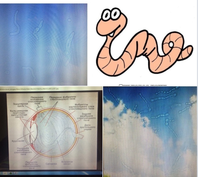 Червяк. 2021год