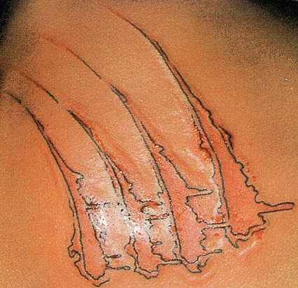 На спине моей лазурные нити...