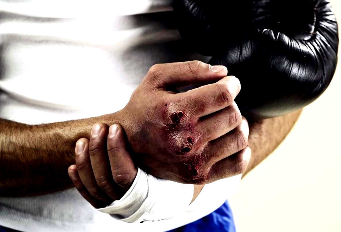 Загадки про Мозоли