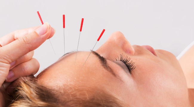 Китайские иголки