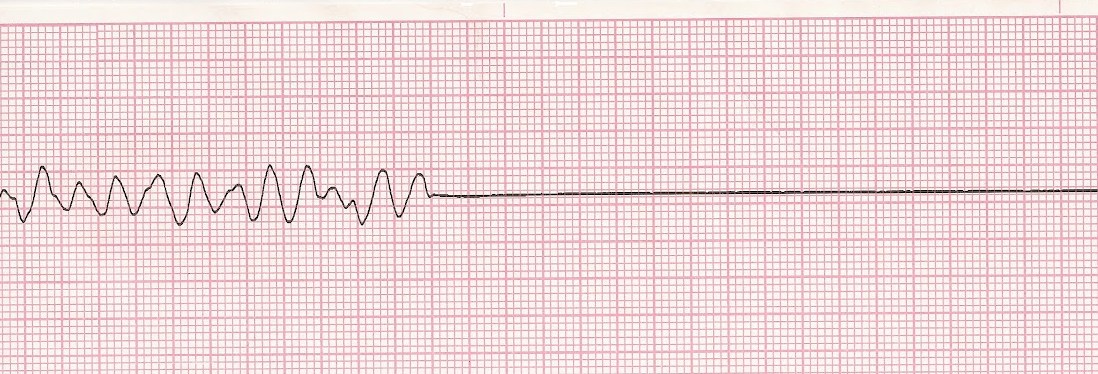 Вышедшее время