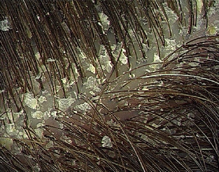 Микровселенная